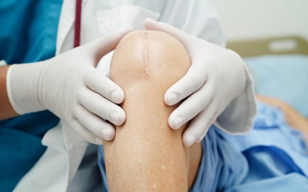 Ce suplimente ajută în recuperarea după operații la genunchi?